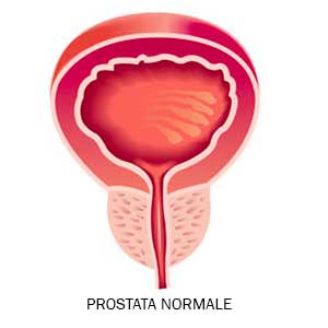 grafica 3d prostata HOME antoniniurology 2021