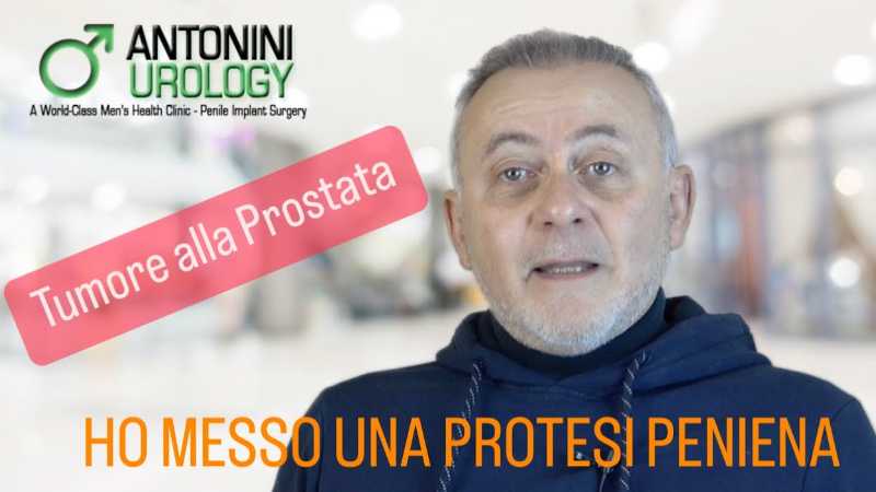 Testimonianza di Romeo, dopo un intervento Protesi Peniena